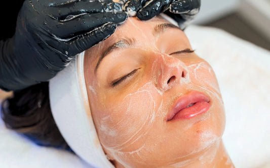Peel Perfection Program
