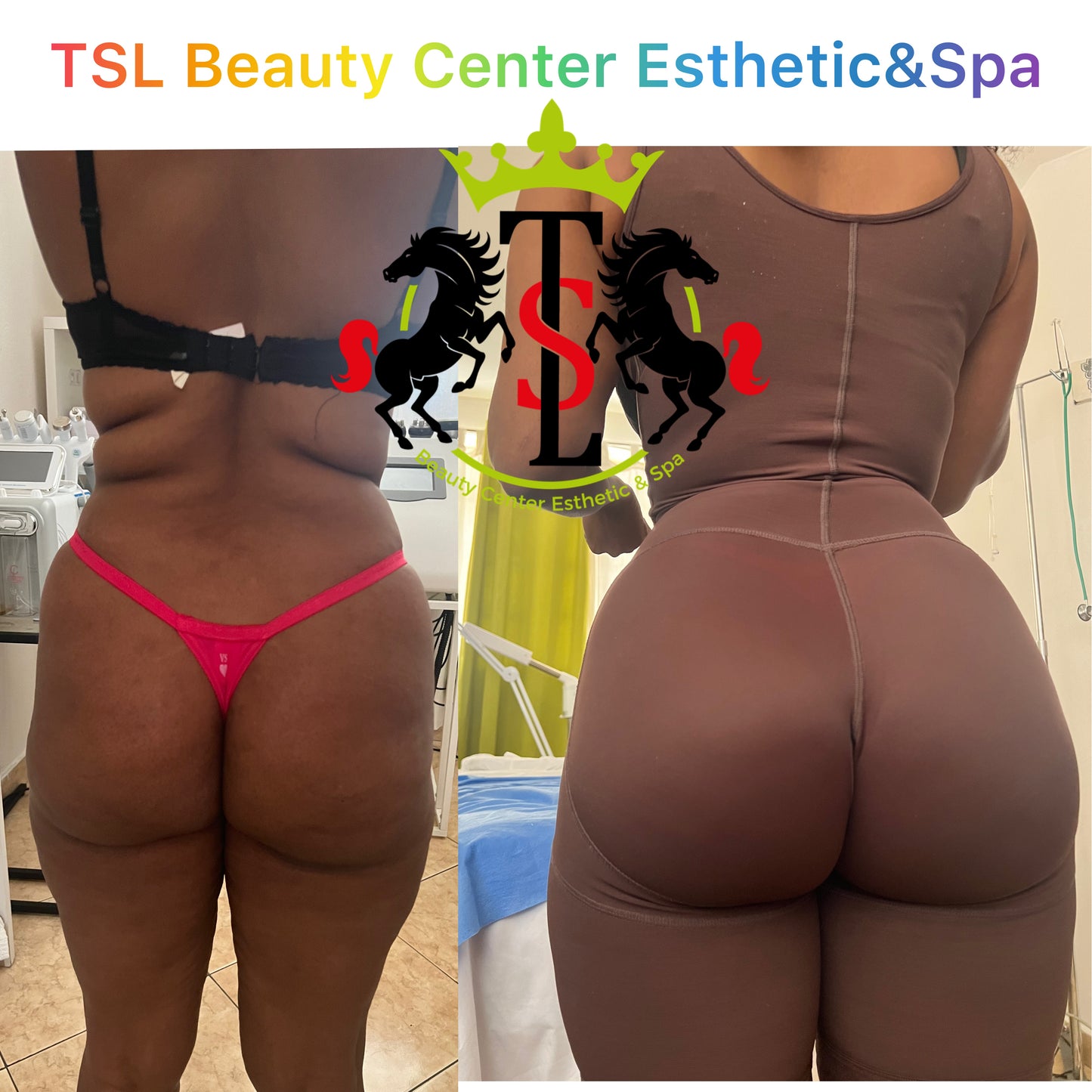 Brazilian Butt Vacuum Deals