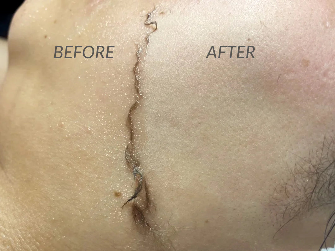 ROYAL SKIN RENEWAL PACKAGE