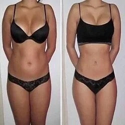 body Slimming