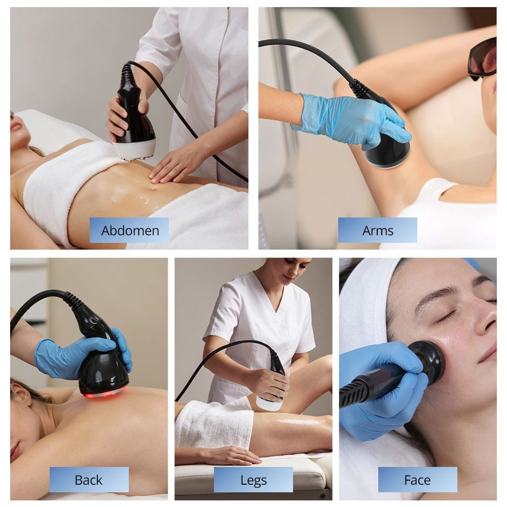 Ultrasonic Cavitation Body Contouring