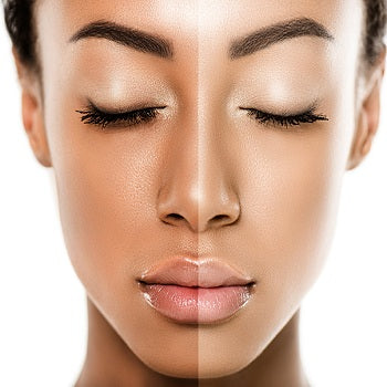 Skin Brightening
