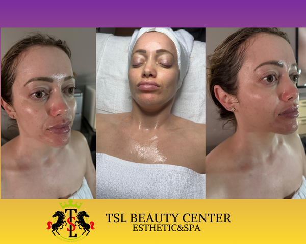 ROYAL SKIN RENEWAL PACKAGE