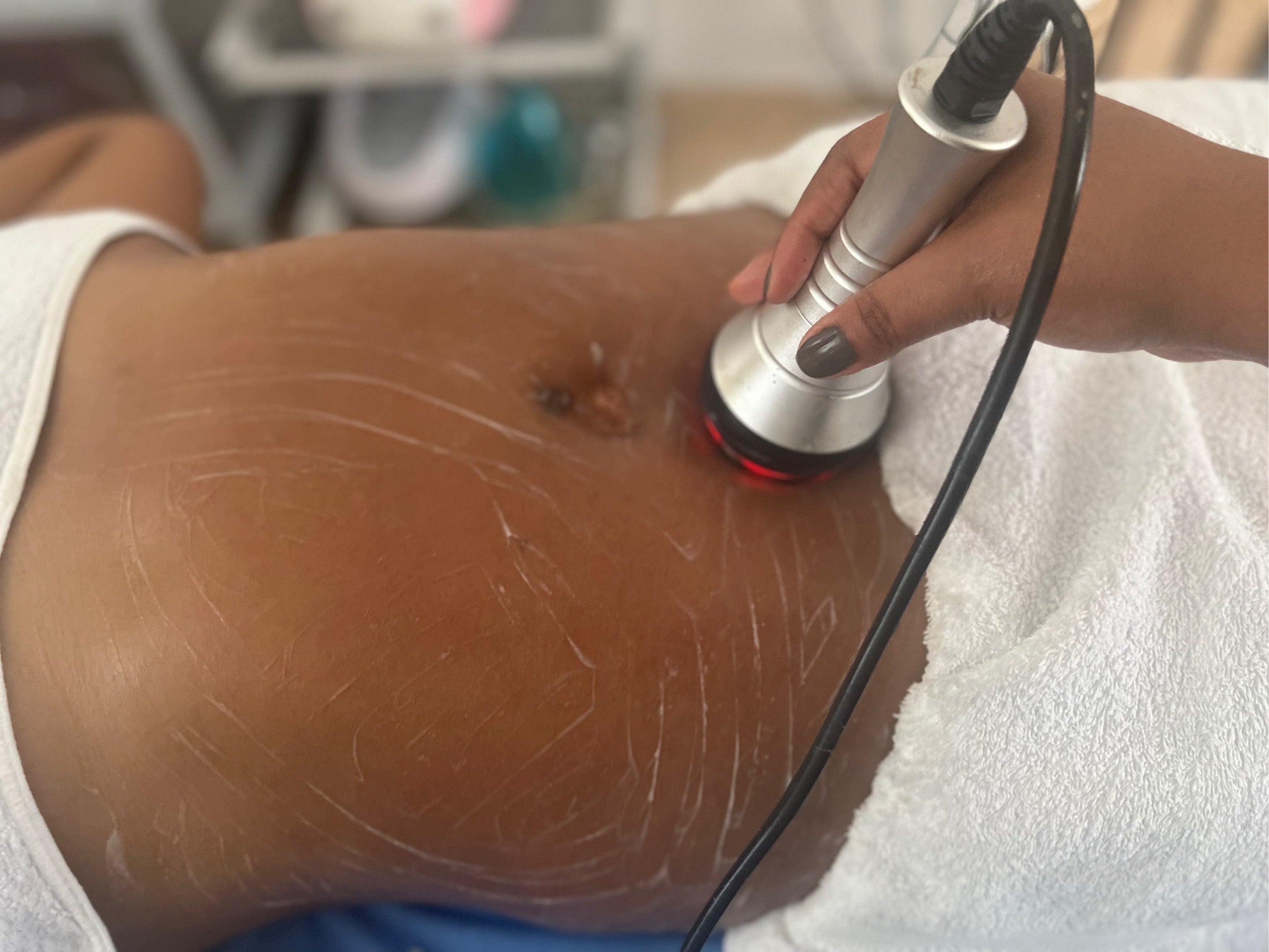 Abdomen 80 K Cavitation
