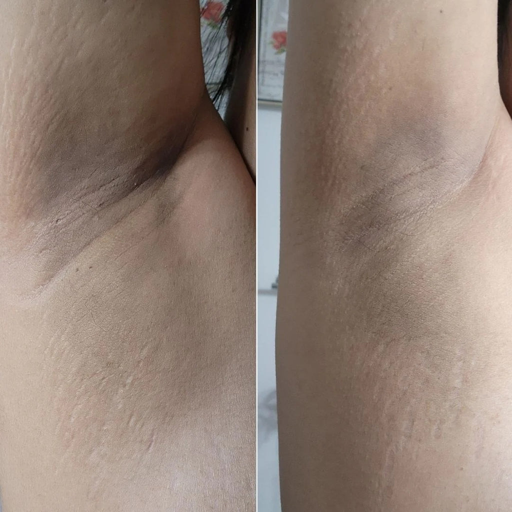 Radiant Reset Exfoliating Toner Pads