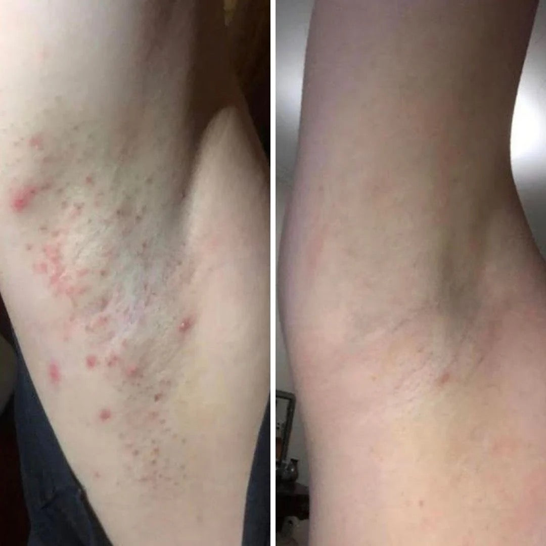 Ingrown Hair Exfoliating Scrub Nude