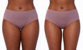 Inner Thighs 80 K Cavitation