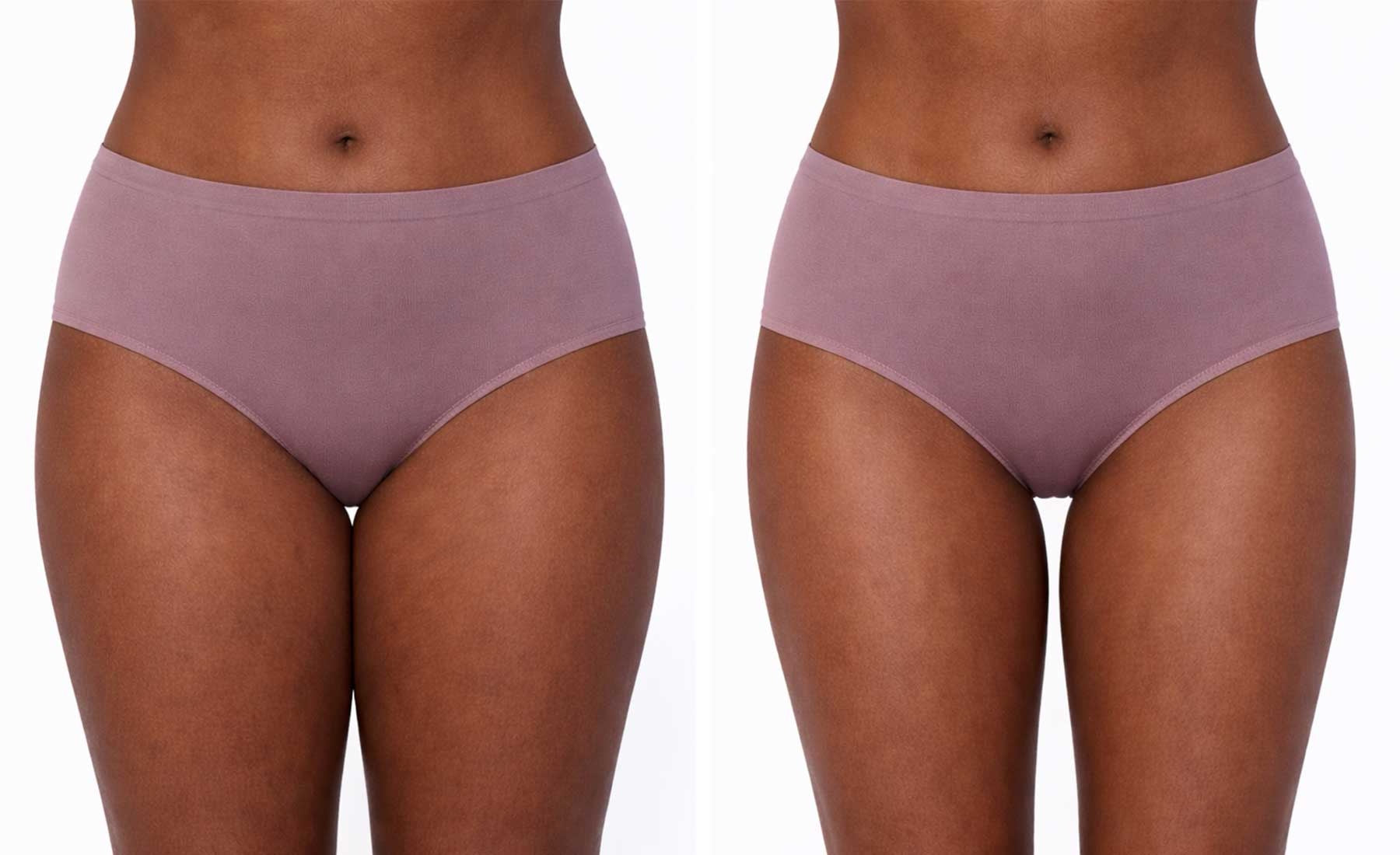 Inner Thighs 80 K Cavitation