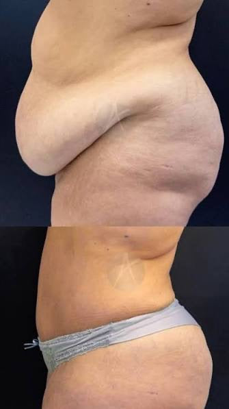 Weight Loss Kit