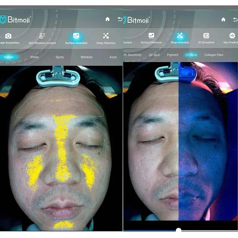 Skin Analysis