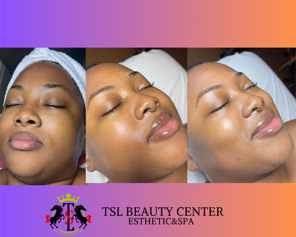 Anti Aging Facial