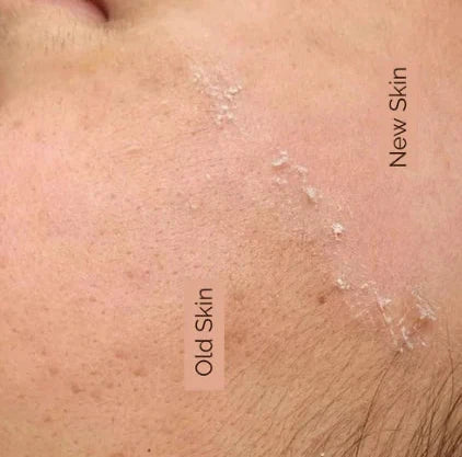 ROYAL SKIN RENEWAL PACKAGE