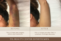 Lymphatic Drainage Massage