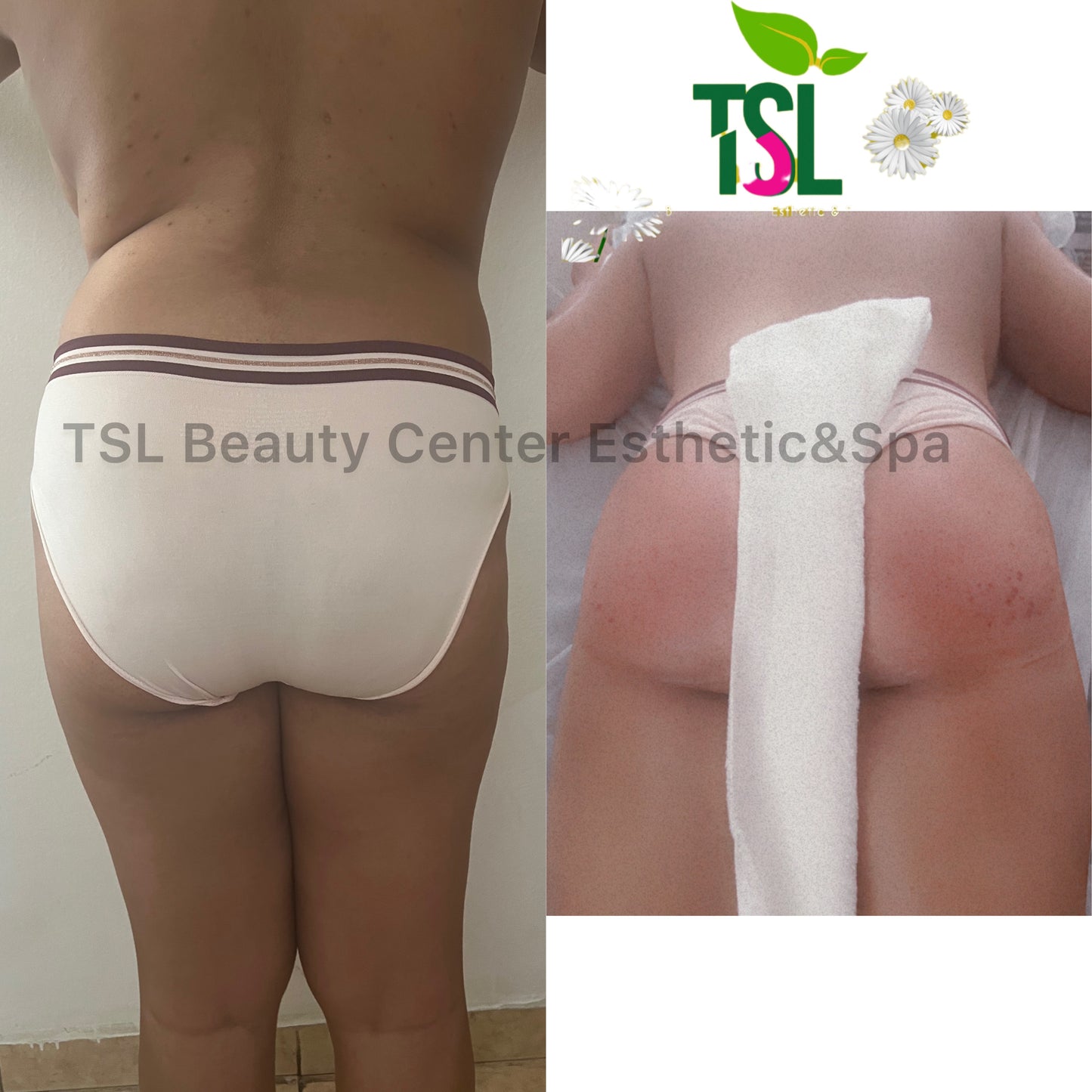 Brazilian Butt Vacuum Deals