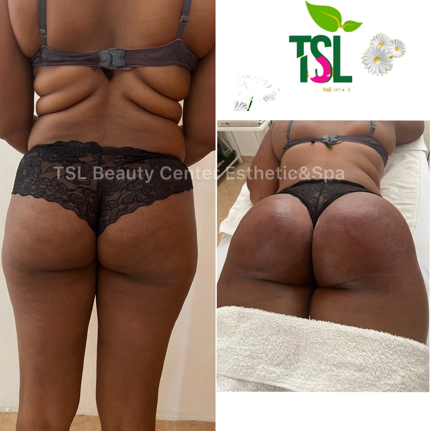 Brazilian Butt Vacuum Deals