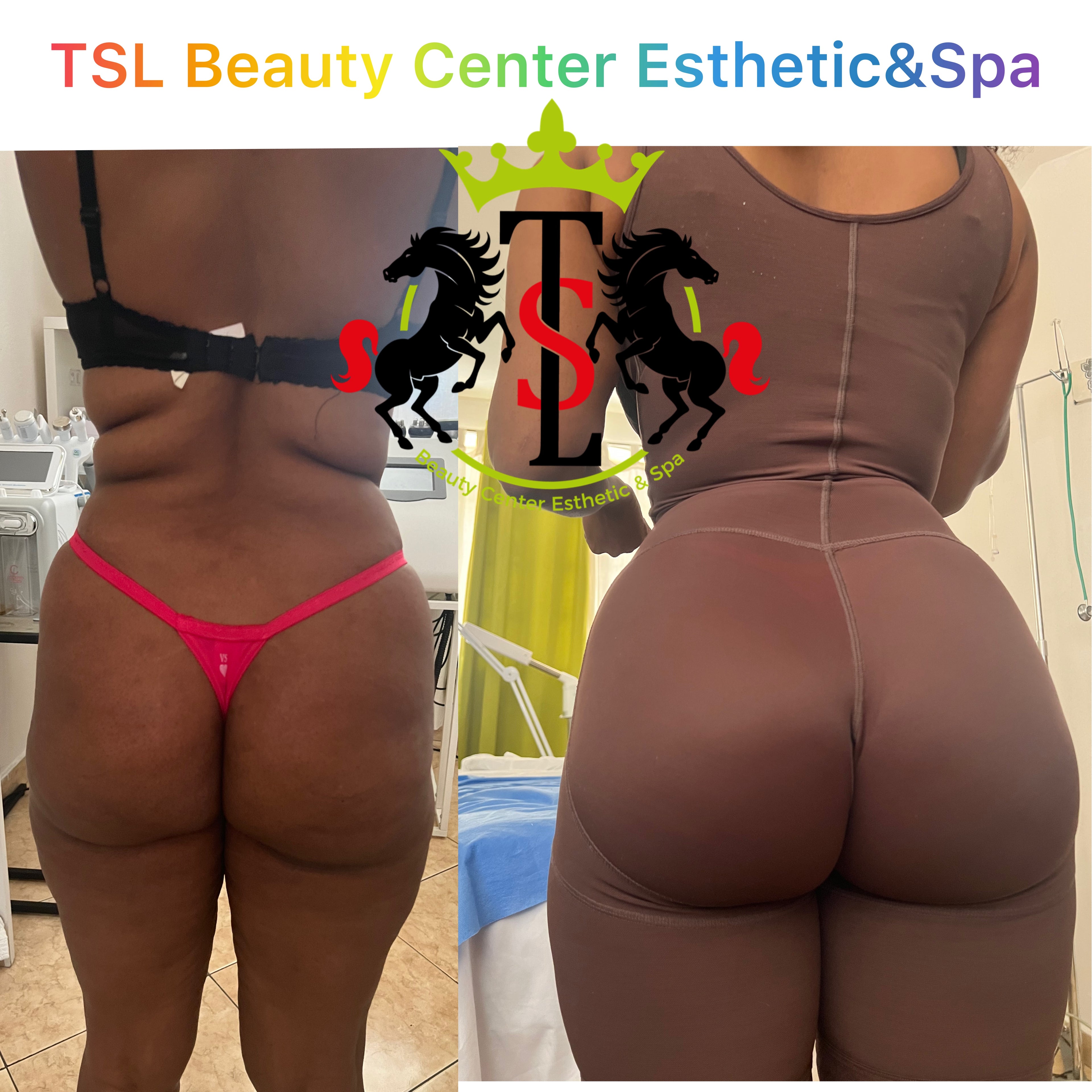 Brazilian Butt Vacuum Deals