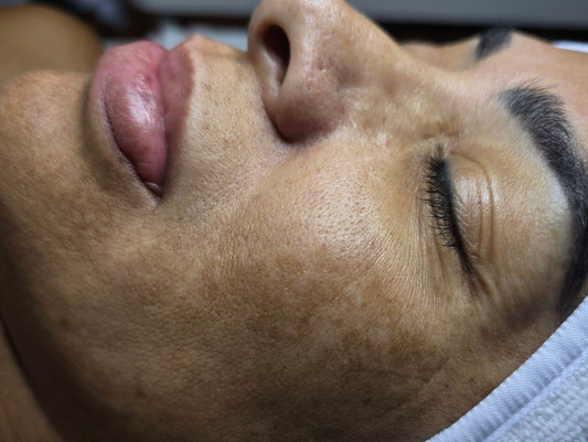MELANIN CLEAR THERAPY FACIAL