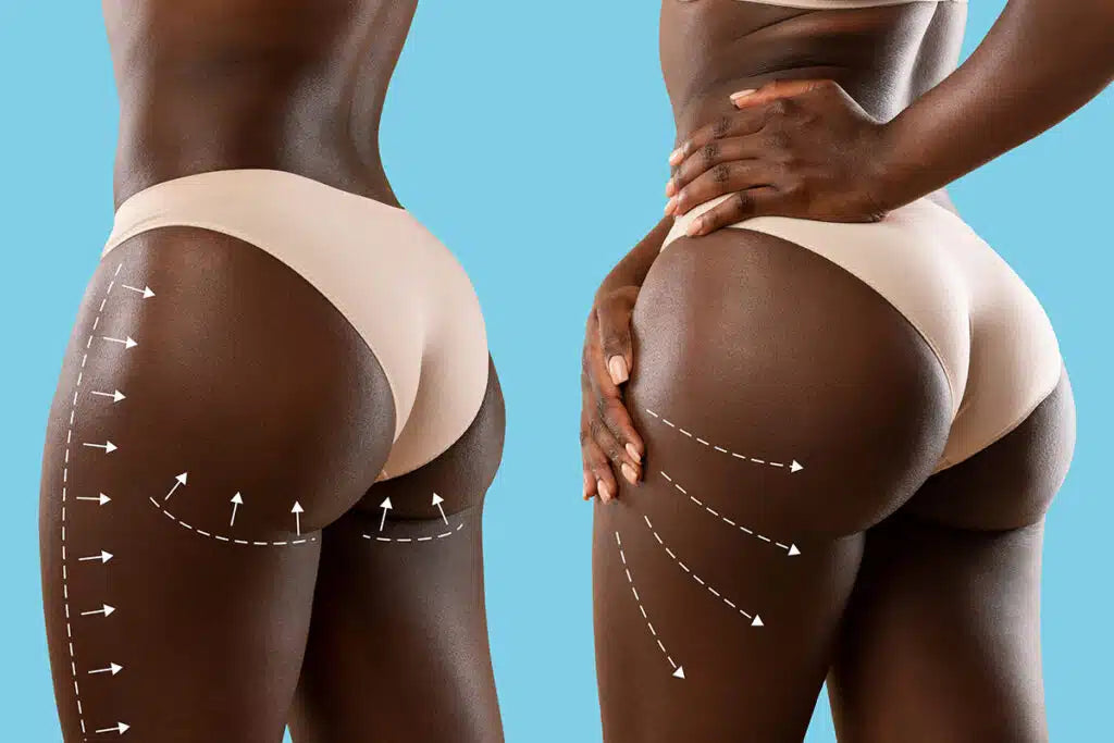 Brazilian Butt Vacuum Deals